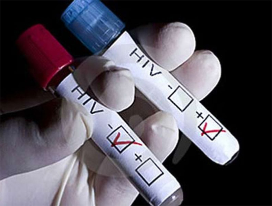 Các liệu pháp điều trị HIV mới: Tăng thêm 10 năm tuổi thọ cho người bệnh